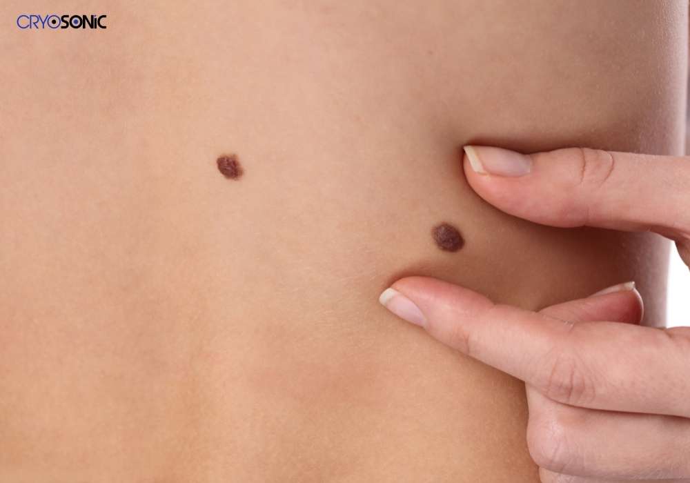Infection Risk and Poor Aftercare Letchworth