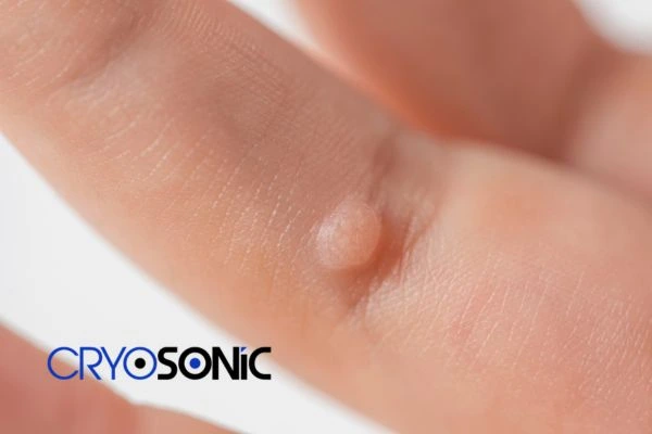 Contact Cryosonic today to learn more about us Letchworth now! Letchworth