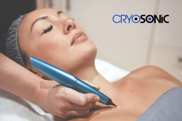 Cryosonic lesion removal prices book today! Letchworth