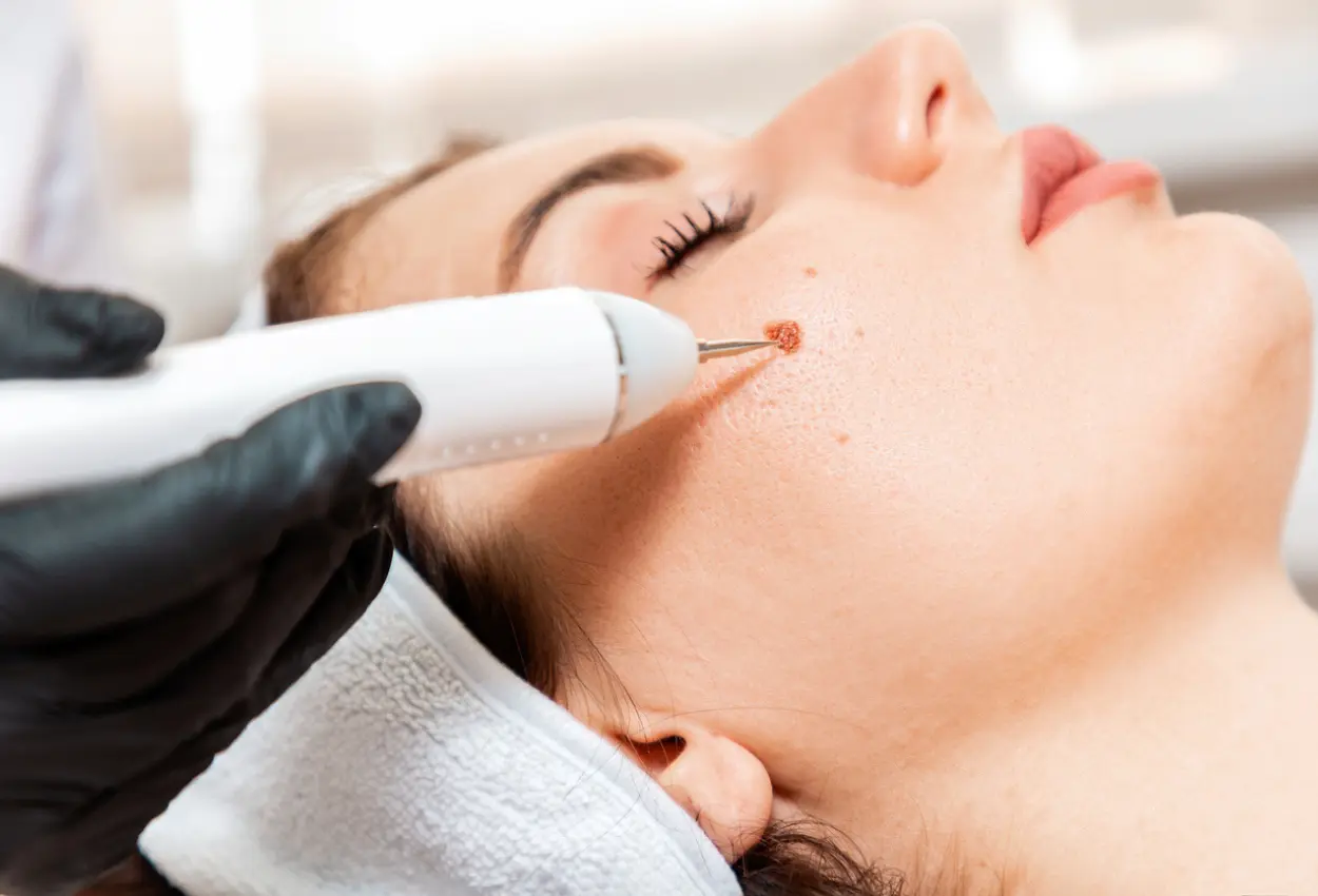 Frequently Asked Questions About Multiple Cryotherapy Treatments Letchworth