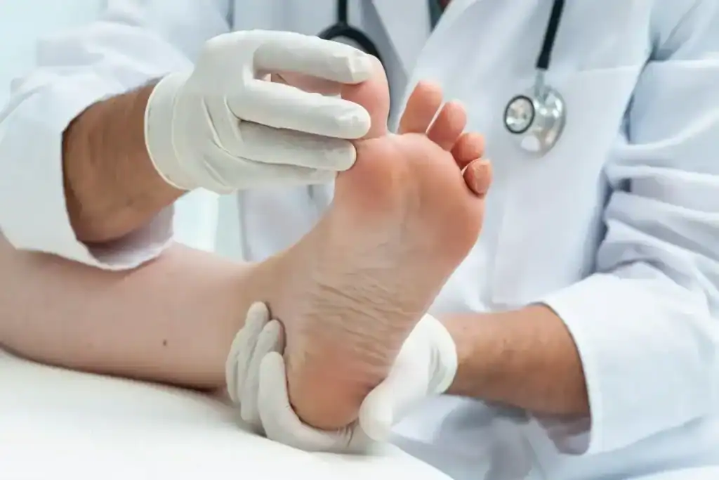 Porokeratosis Removal Treatment Letchworth
